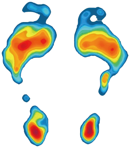 インソールあり足底圧