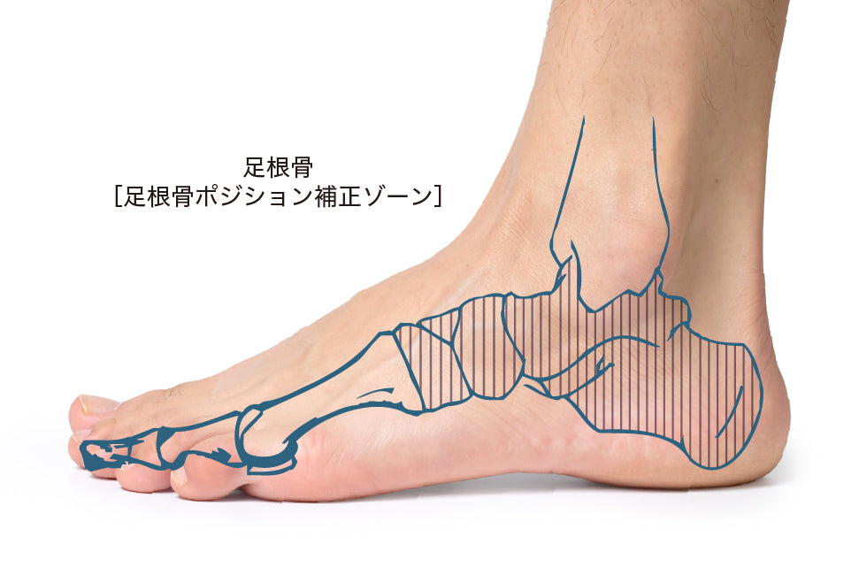 3アーチのサポート